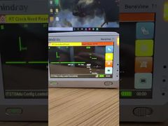 Узнайте, почему следует выбирать монитор пациента Mindray BeneView T1 с ЖК-экраном и передней крышкой