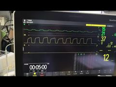 Посмотреть демо-версию модуля Mindray AG AG и модуля O2 MMS, номер по каталогу 115-023943-00