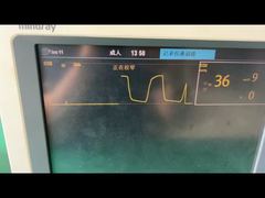 Более пристальный взгляд: водоотделитель Mindray для модуля 9200-10-10530 для взрослых и педиатрических наркозных газов
